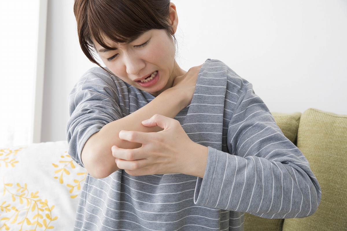 アトピー性皮膚炎とは